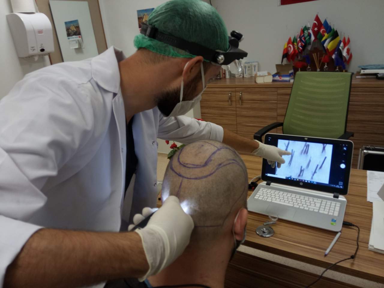 Turismo capilar en Turquía en la empresa española Fue Hair Transplant System