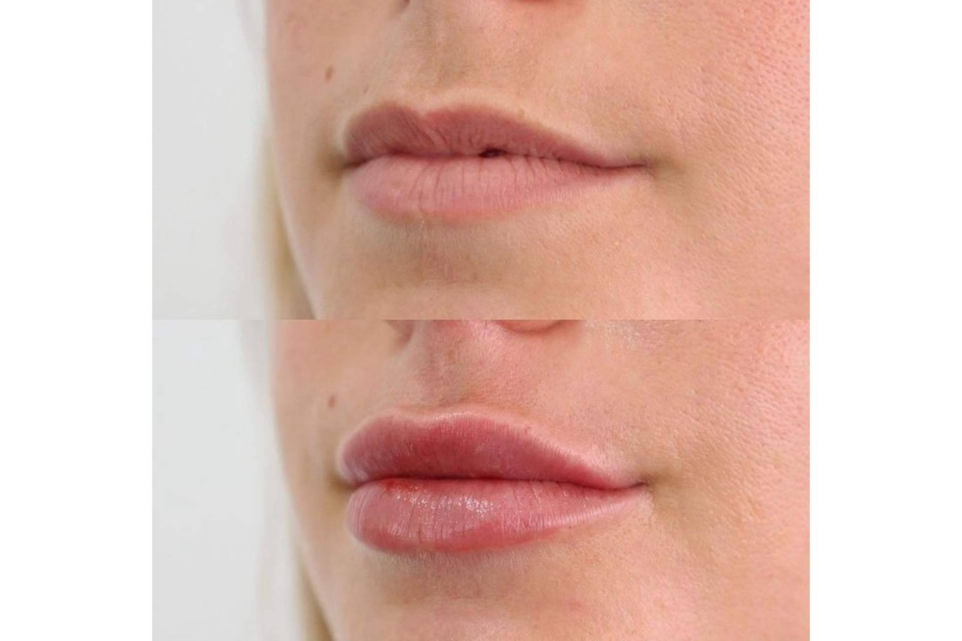 Revitalizar la expresión facial de mujeres y hombres mediante los tratamientos estéticos del doctor Castellar