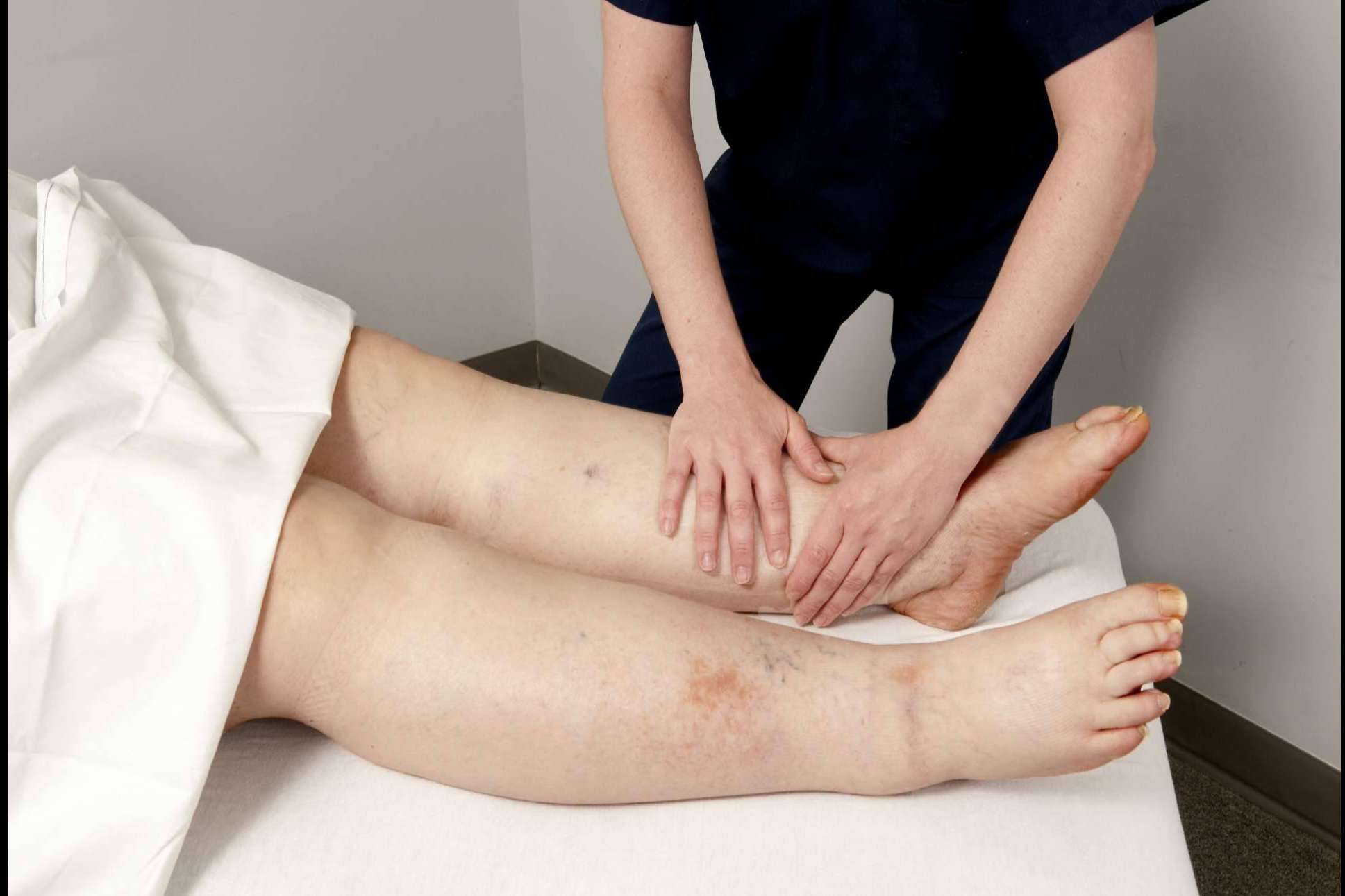 Clínica Mimar Fisioterapia: confiar en los expertos en el tratamiento del linfedema en Valencia