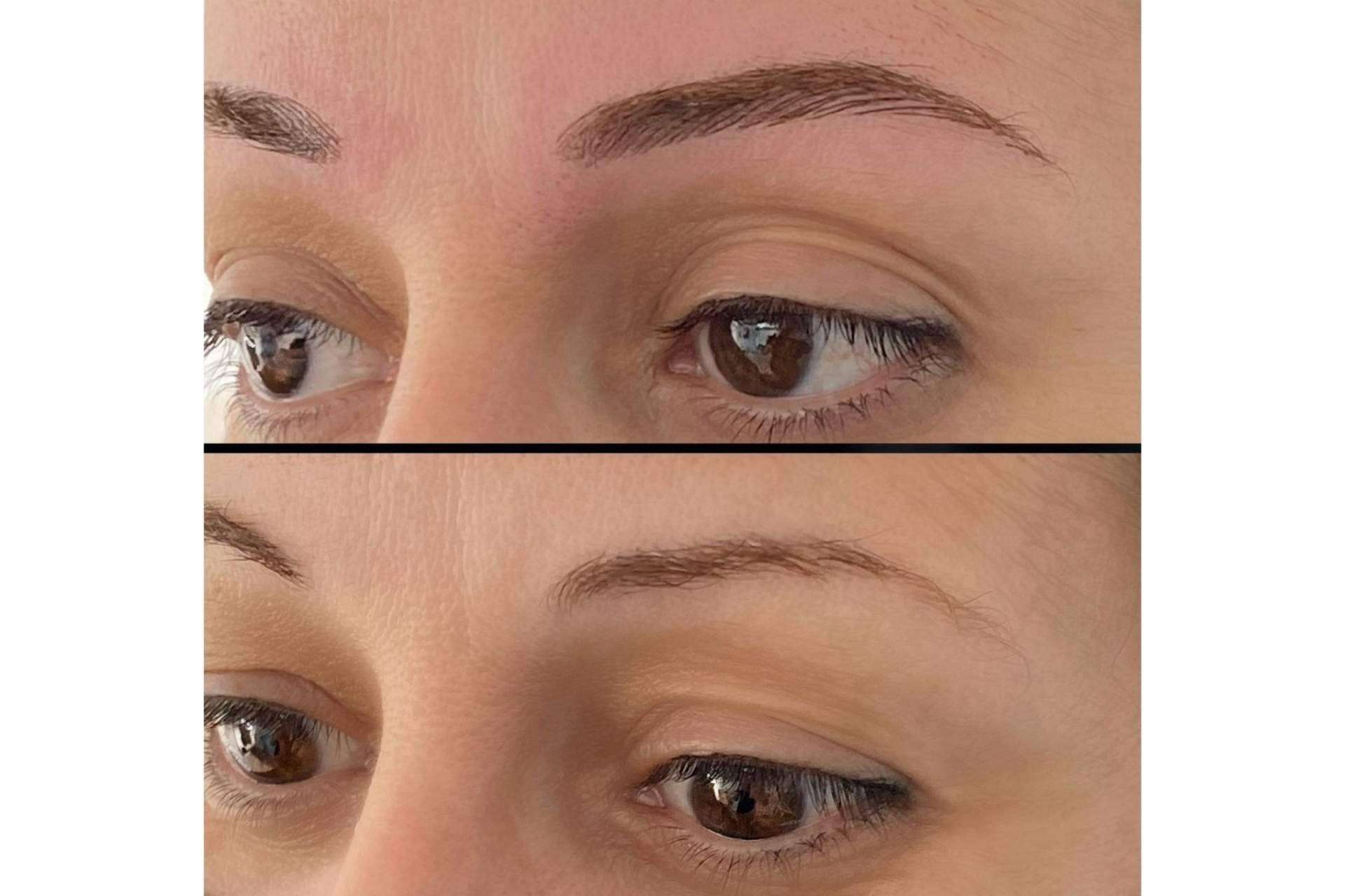 Lucir una cara siempre perfecta con el microblading de la Dra. Julieta Gil