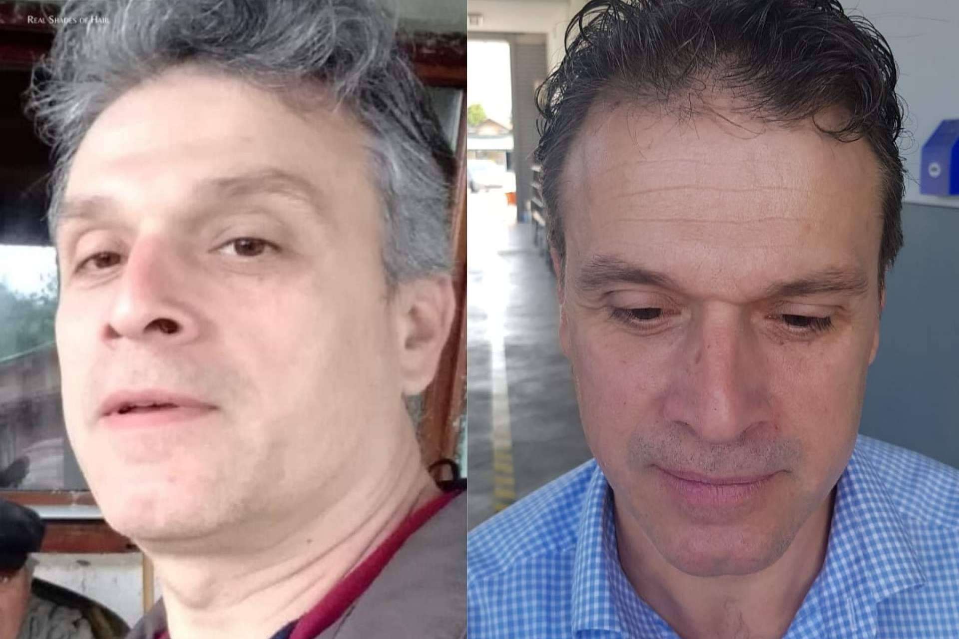 GR-7 Professional: la sinergia de 4 componentes naturales para erradicar las canas