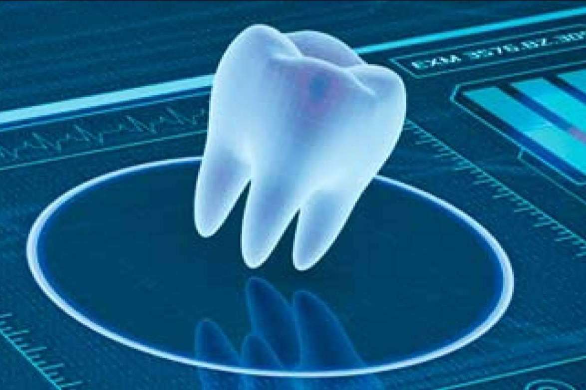 Las técnicas avanzadas en implantología: odontología digital de la mano de Clínica Blay Monzó