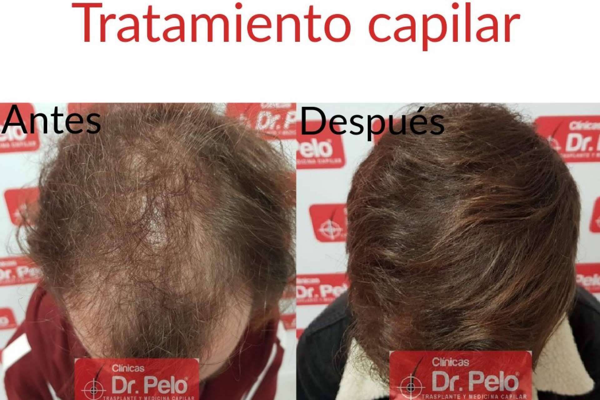 Las Clínicas Dr. Pelo ofrecen todo tipo de tratamientos capilares