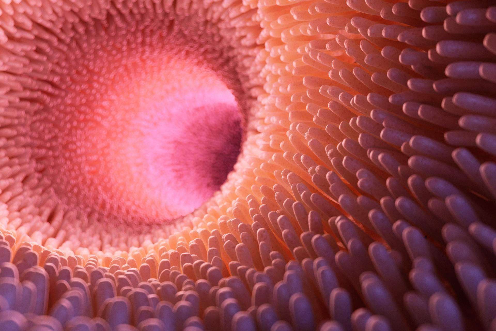 ¿Hay algún tratamiento para la disbiosis intestinal?