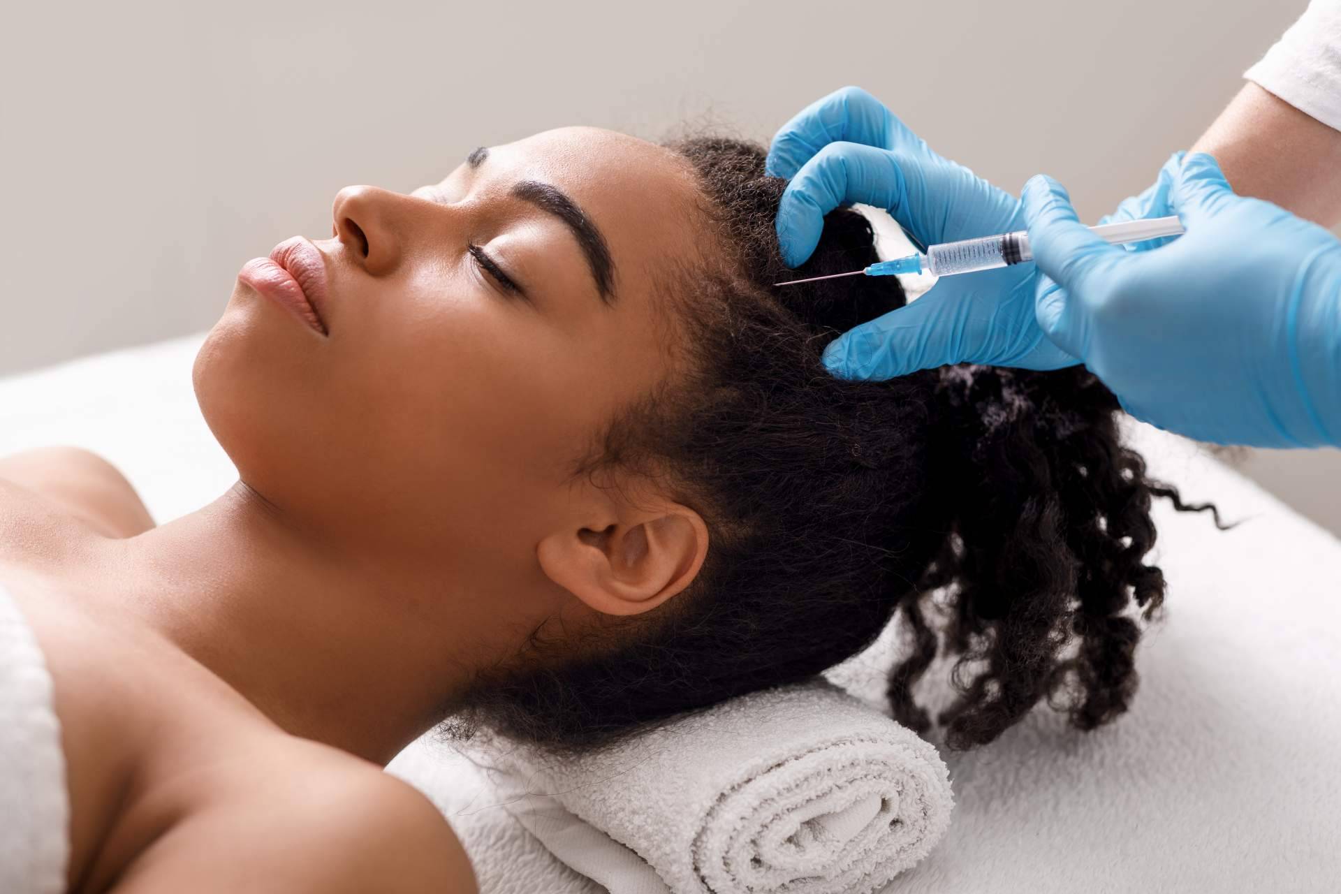 ¿Qué beneficios aporta la mesoterapia capilar que realiza el Dr. Bruno Jacobovski?