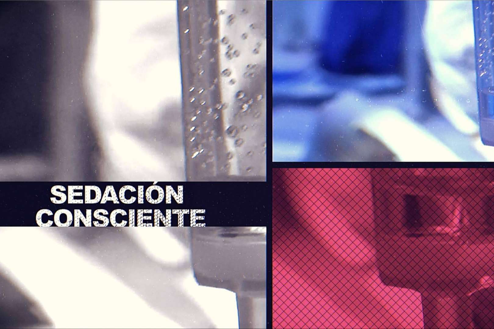 Sedación consciente en la clínica dental Formación en Implantología para aquellos pacientes nerviosos o con fobia al dentista