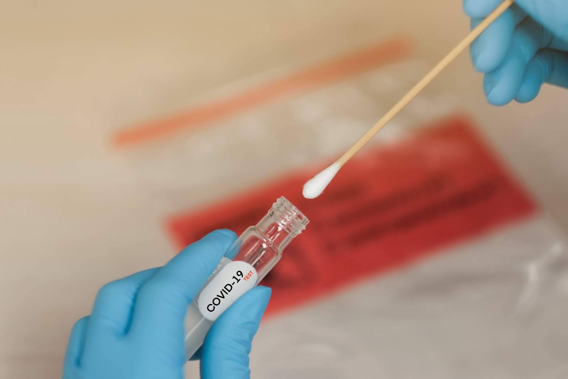 Centro Médico Bravo explica la importancia de realizarse un test COVID aunque se tenga la pauta de vacunación completa