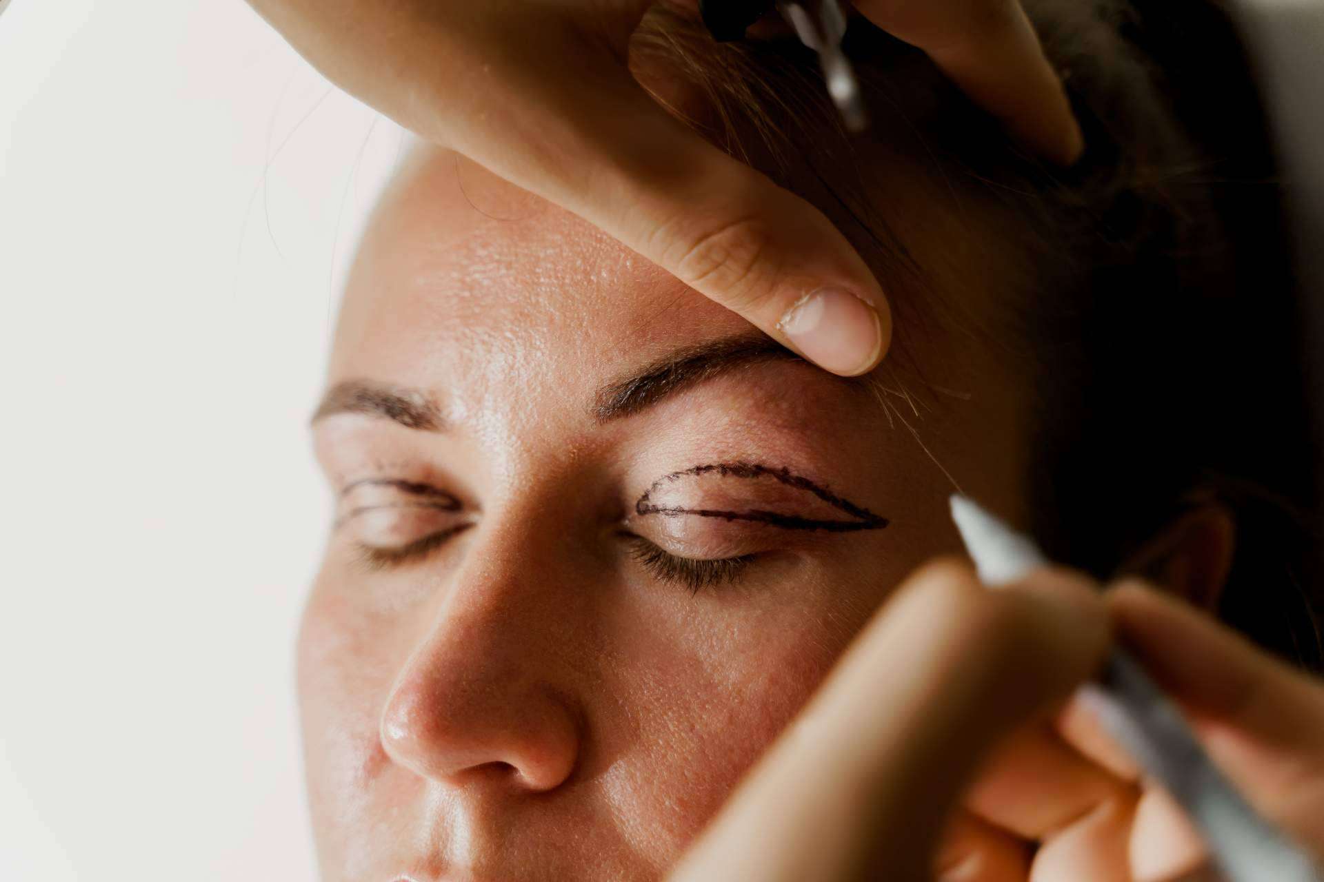 ¿Qué es la blefaroplastia no quirúrgica para el tratamiento de párpados superiores o inferiores?