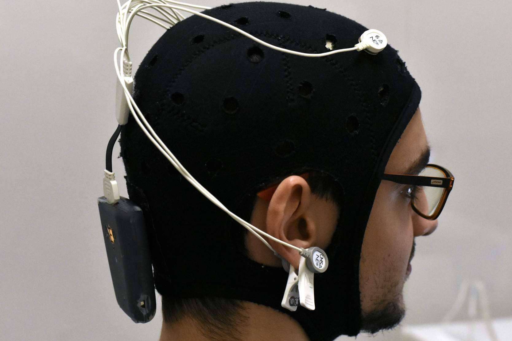 Recuperación tras sufrir un ictus gracias a los tratamientos de neuromodulación