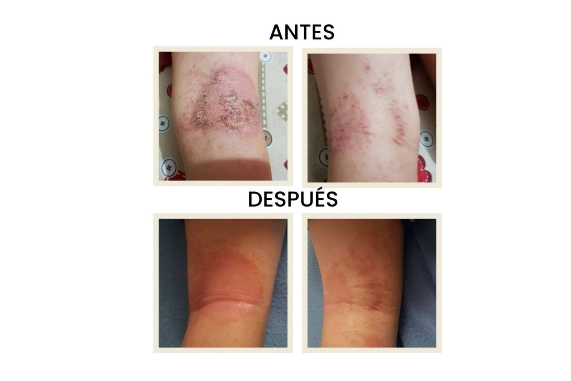 Revolución en la dermocosmética natural con el pack de Green Cornerss