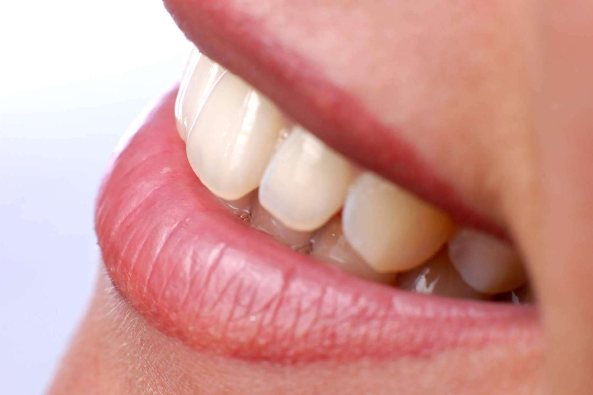 Implantes dentales para una sonrisa sana y bonita, en Sitges Barcelona con Calident