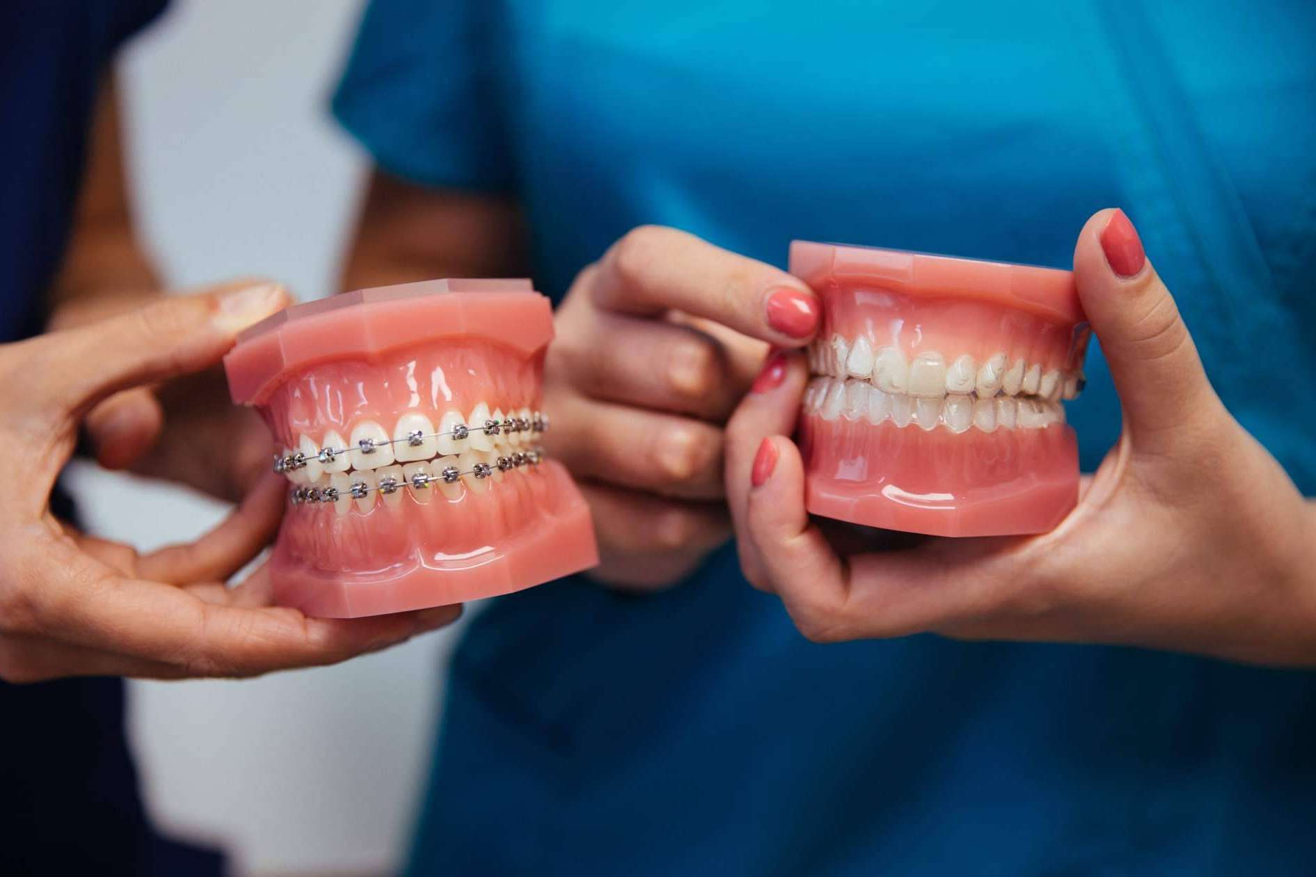 ¿Qué 5 ventajas supone la ortodoncia invisible Invisalign frente a los brackets?, con Dientes Redondos