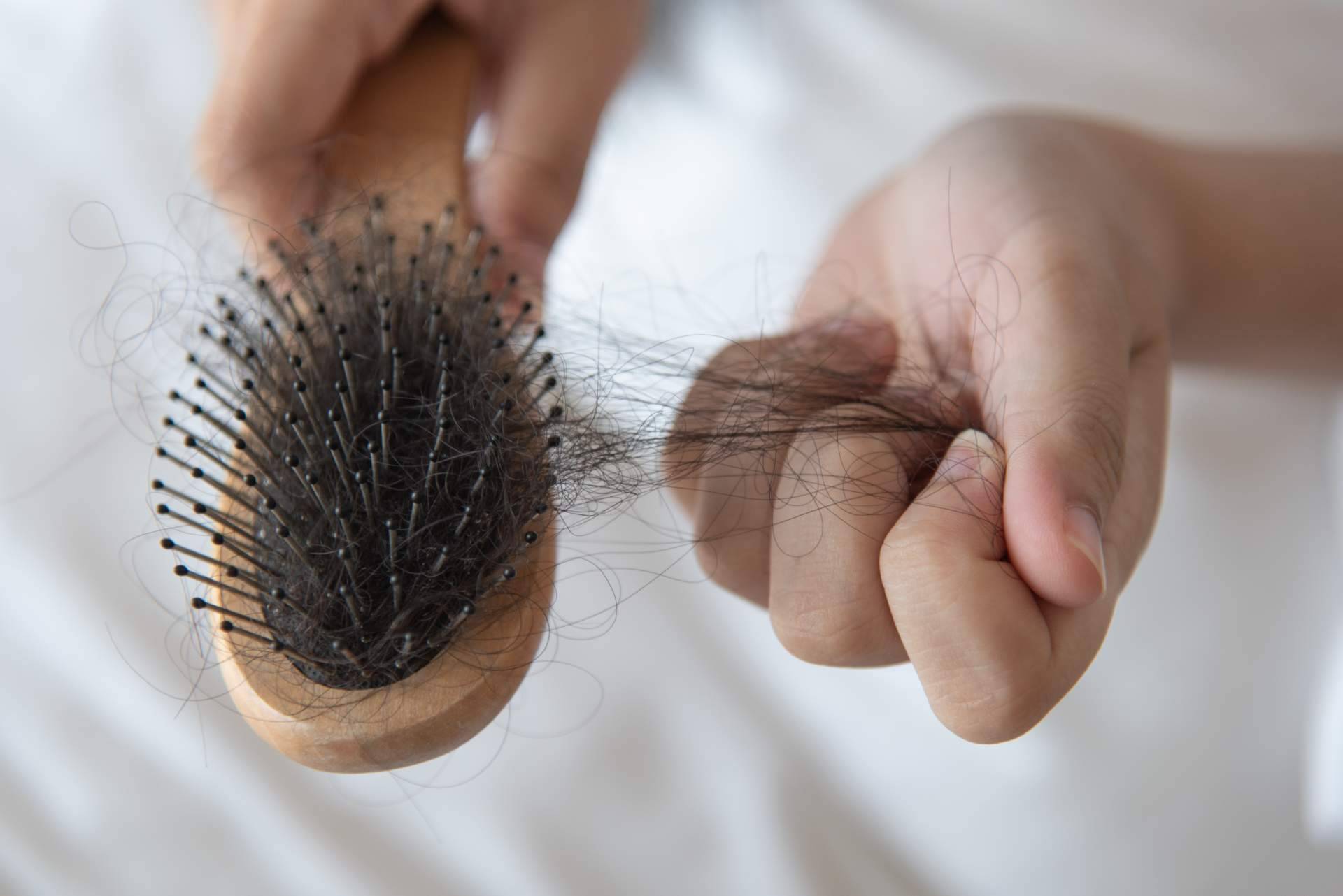 Los médicos de Capilar Innovation Clinic son especialistas en cualquier tipo de alopecia femenina