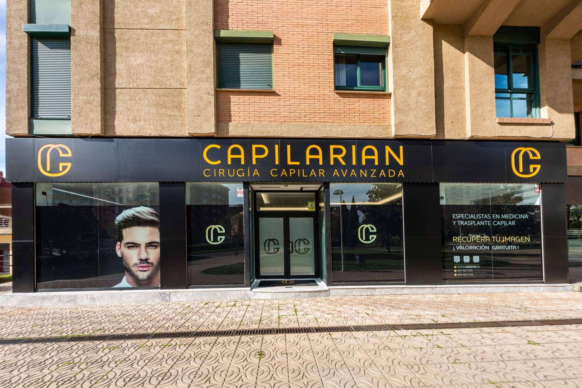 Todo lo que hay que saber acerca de la mesoterapia capilar, con Capilarian