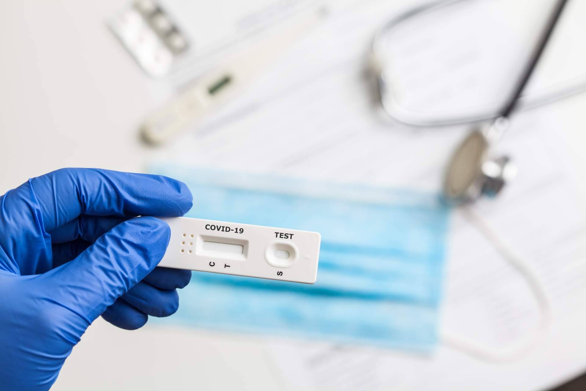 Diferentes test de covid que se pueden realizar, de la mano de Centro Médico Bravo