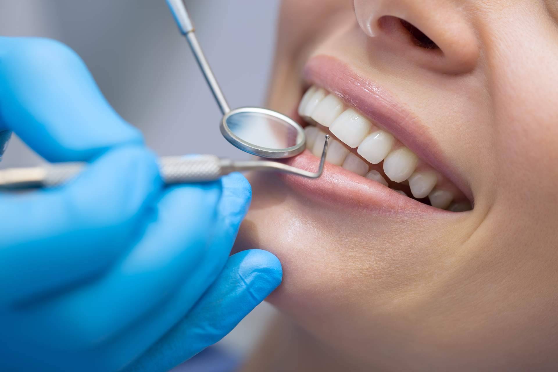 Todo tipo de tratamientos para la estética dental de la mano de los profesionales de ResidentLive