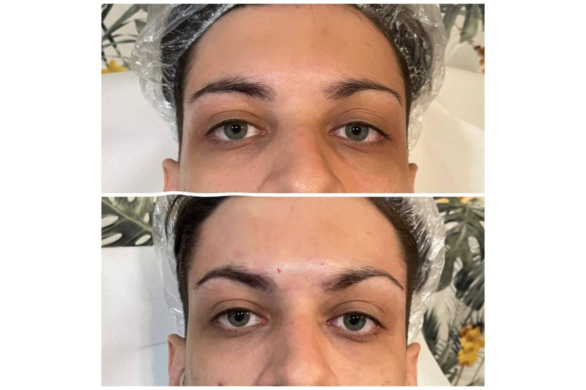 Realizar el tratamiento de los foxy eyes con Cecilia Arthur