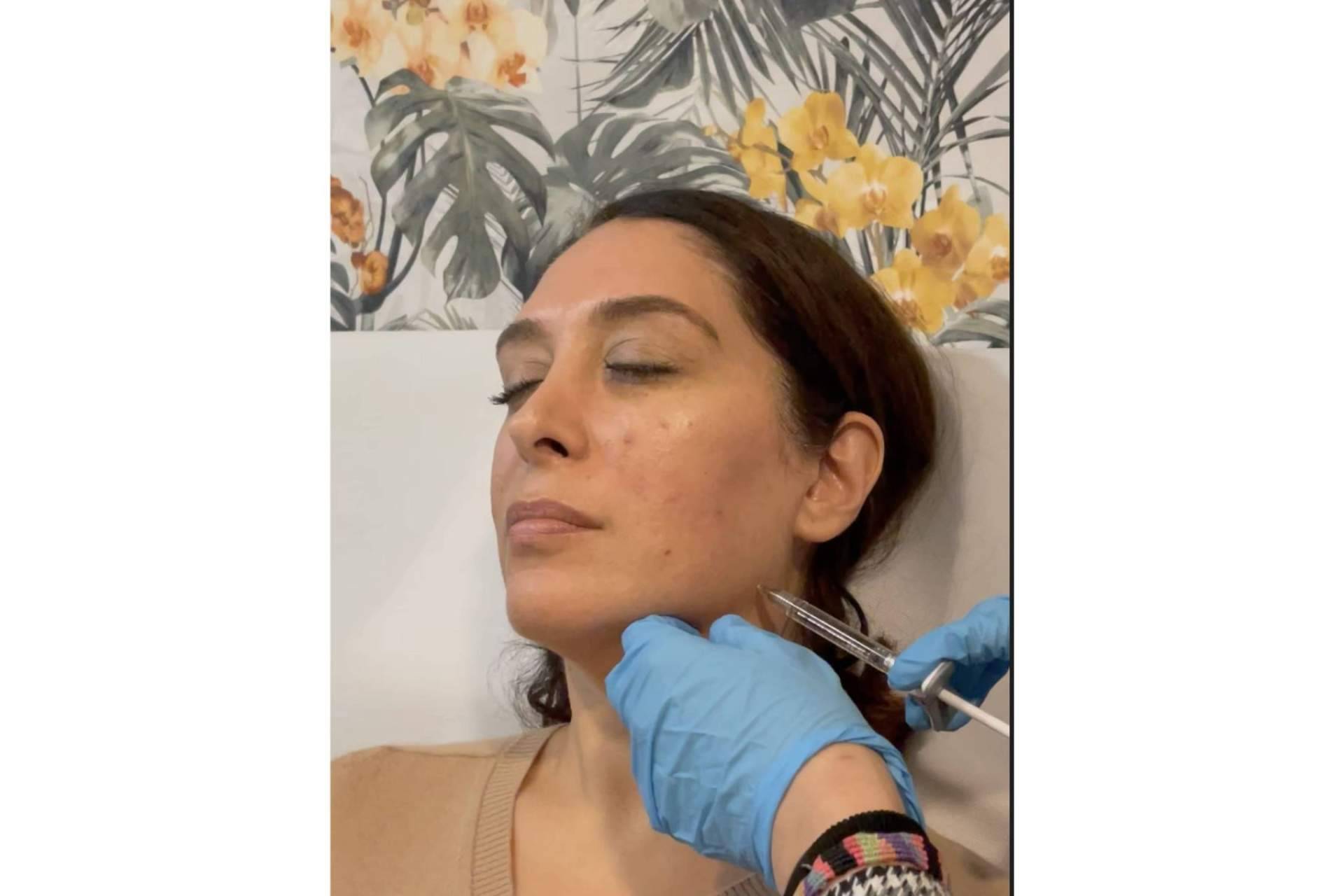 Dónde y por qué someterse a una marcación mandibular, con Cecilia Arthur