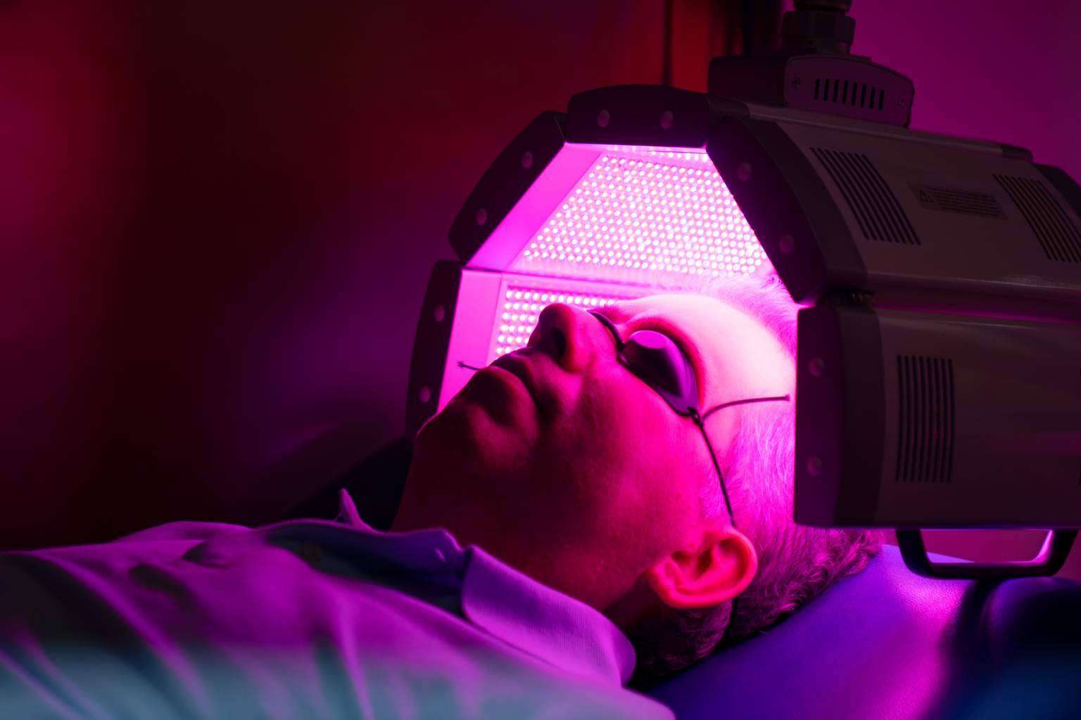 El tratamiento no invasivo de fototerapia LED capilar para combatir la caída del cabello