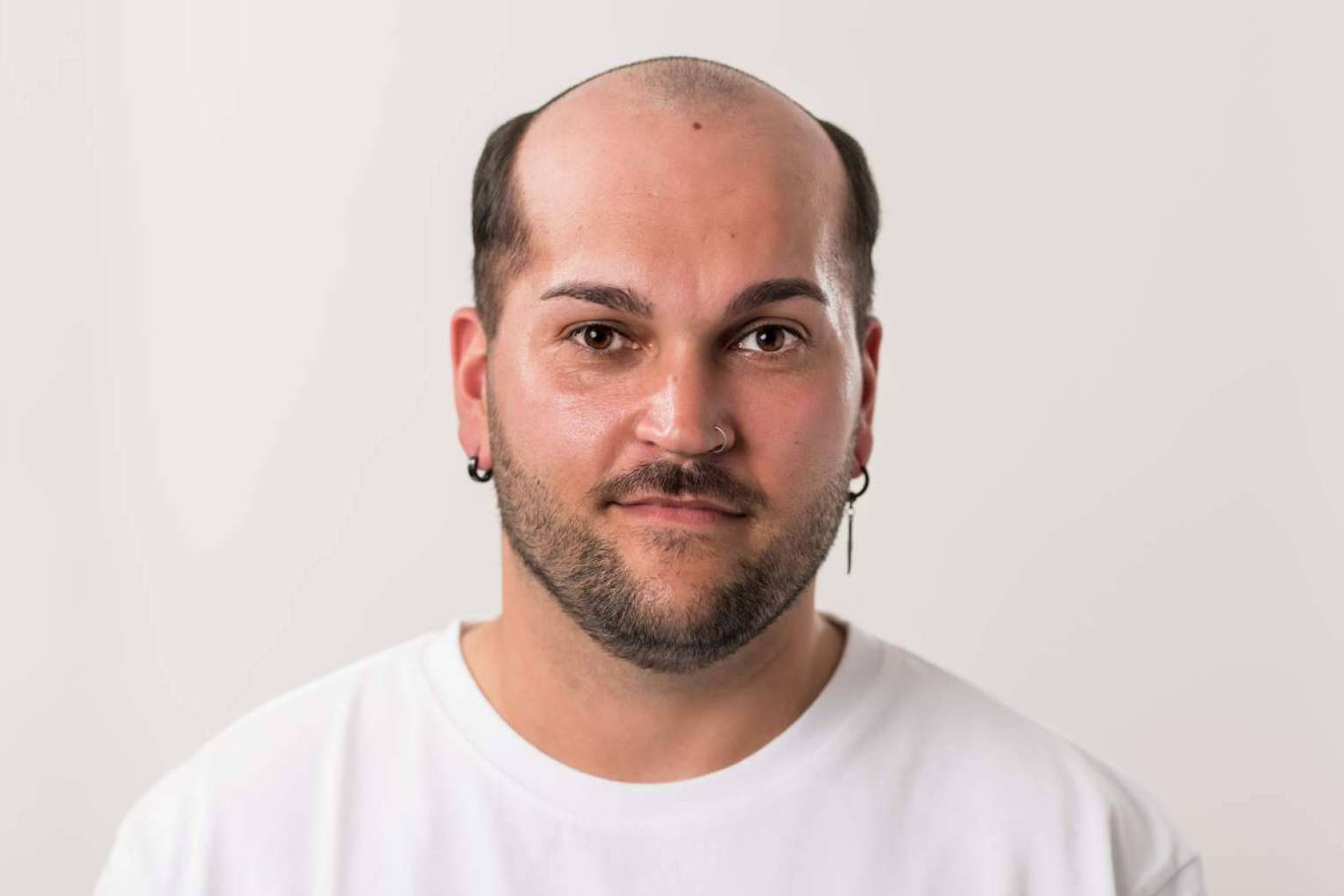 Las prótesis capilares para hombre, un mercado en auge, de la mano de Hair Inspira