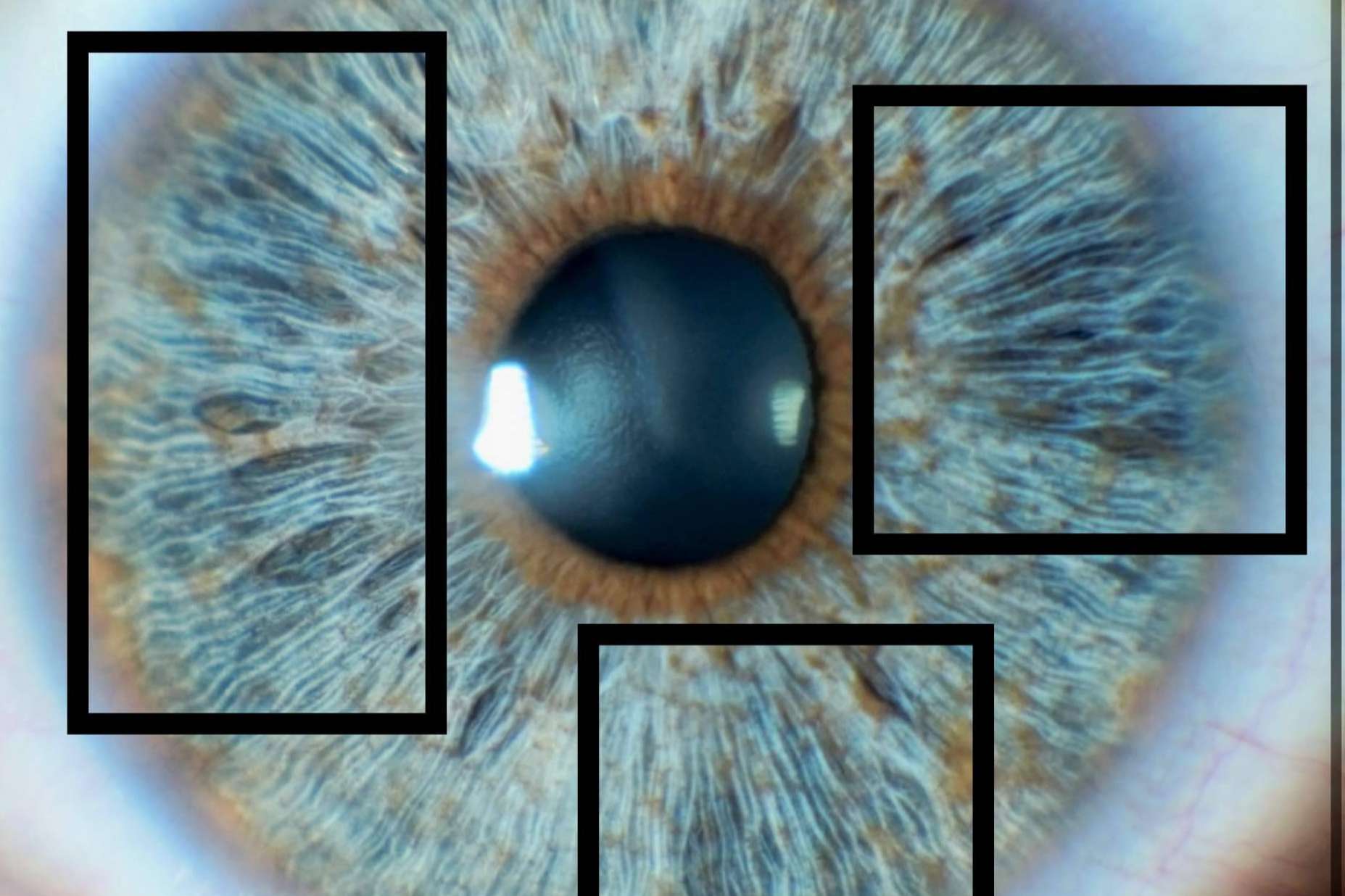 Colágeno del iris y su importancia en el brillo de los ojos