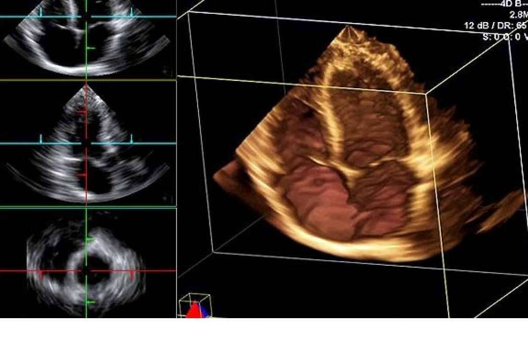 Ecógrafos avanzados y atención técnica personalizada, la nueva propuesta de SCPmedical para el sector sanitario