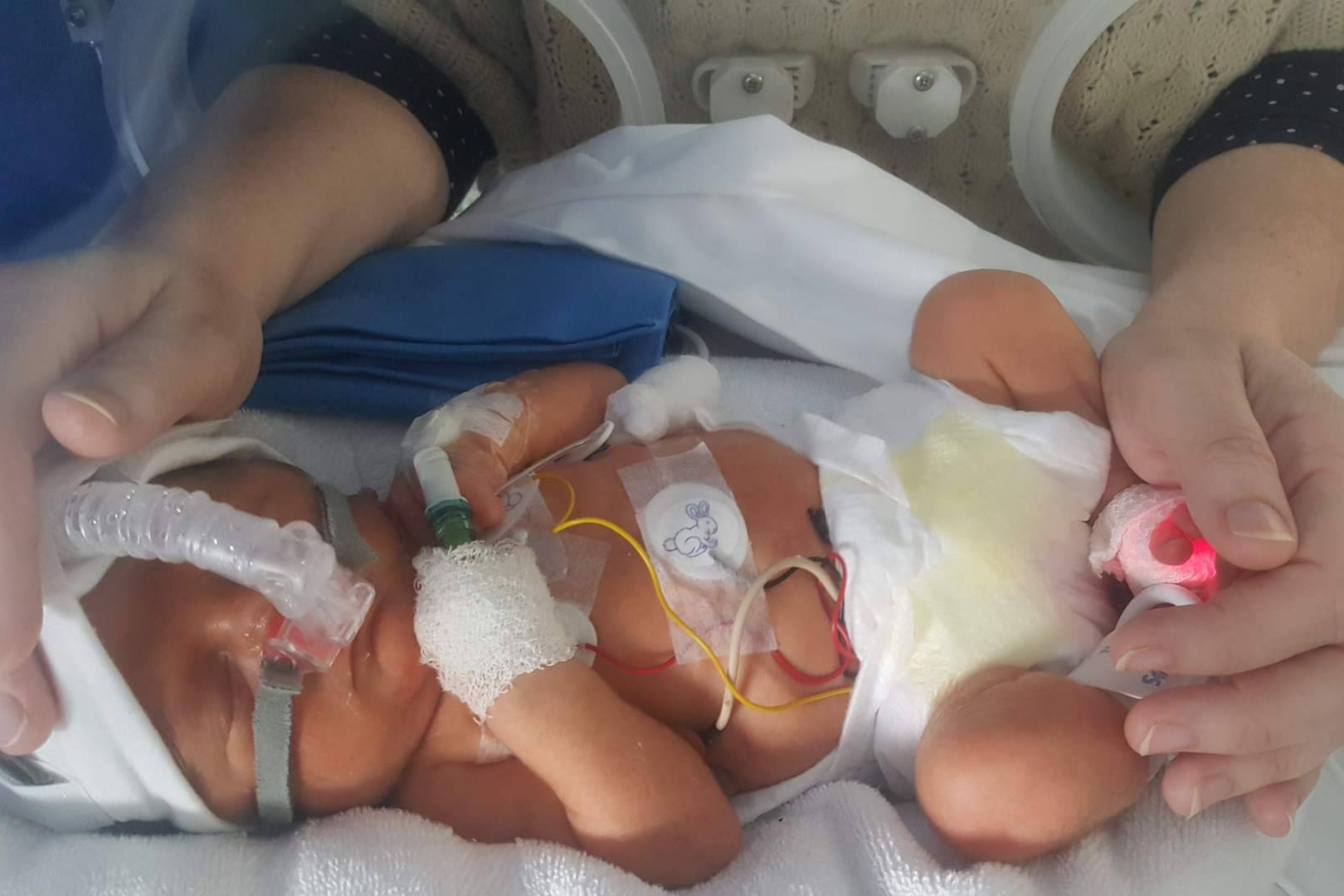 Día Mundial de la Prematuridad; detrás de cada bebé hay una familia que no se rinde